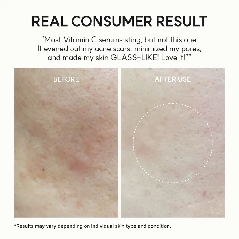 "Skin-Renewing" Dual-Action Duo — A pairing of Vitamin C and retinal that works synergistically day and night to brighten the complexion, refine pores, deeply hydrate, and fade dark spots.