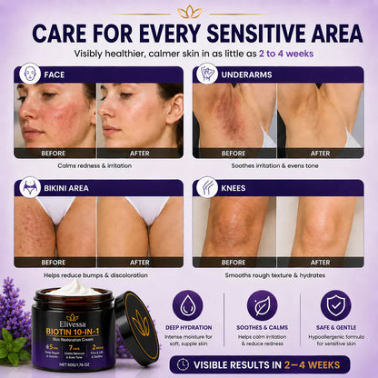 Limited-time offer: 70% off ⬇️Elivessa™ Biotin 10-in-1 Skin Restoration Cream